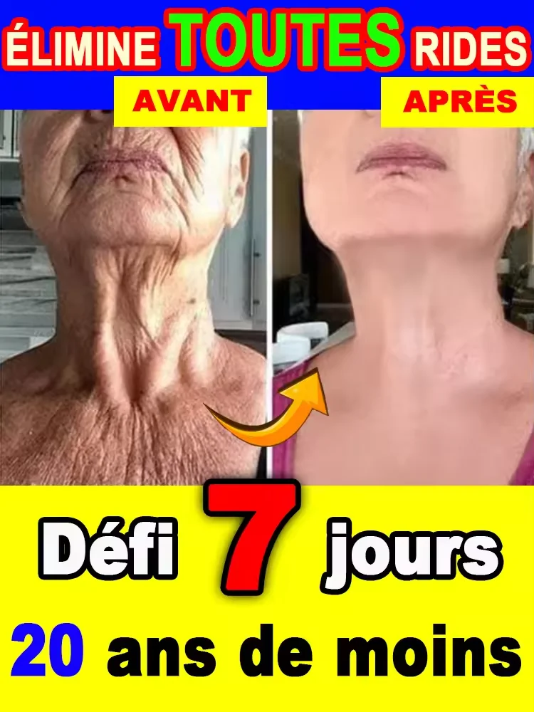 دافئ وخالي من التجاعيد في عام 2025. جلد كامل الجسم، يجلب نفسه إلى سن 18 عامًا