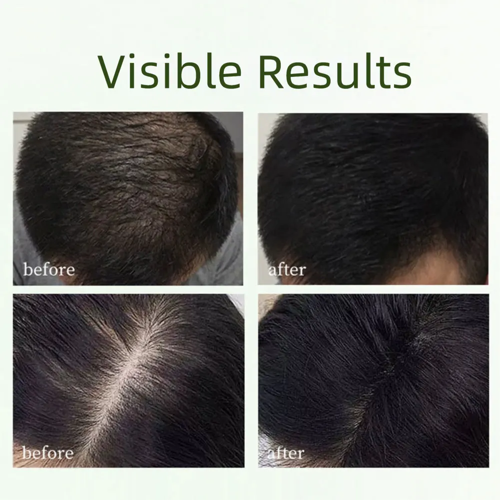 

Nature Seven Green Шампунь-батончик Нежное очищение Питательный уход за здоровыми волосами Для ухода за волосами