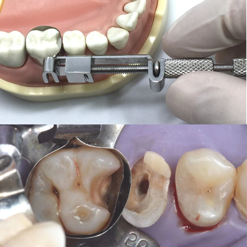 Dentystyczna matryca toflemire dziąsłowa ściana zespół podnoszenia profilowane taśmy matrycowe klinowe paski do polerowania żywicy narzędzia do