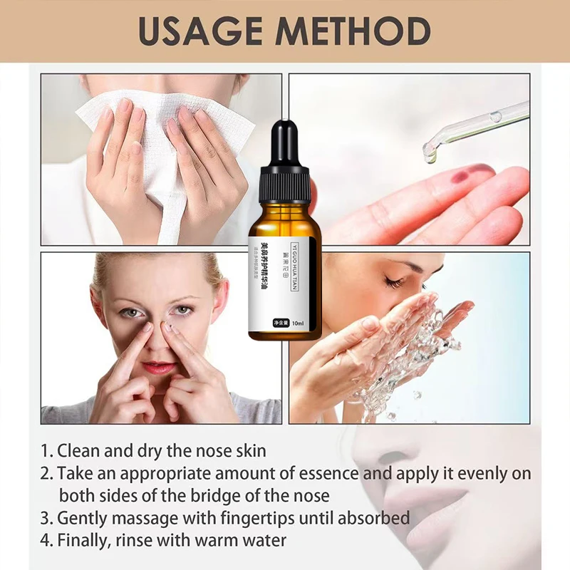 Reduce the nose and increase the bridge of the nose, thin and fat the nose, correct the nose augmentation, and tilt the nose