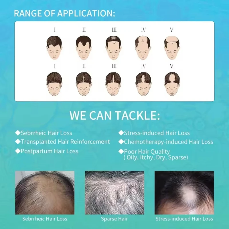 

Laser Hair Regrowth Helmet 96 Diodes Full Scalp Coverage for Men & Women