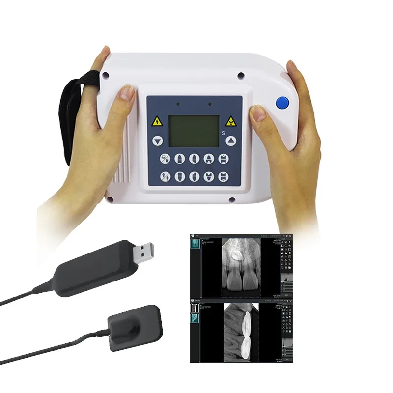 X Ray Machine Por   Digital X Ray Machine Handheld Small Oral Diagnostic EquipmentVeterinary equipment