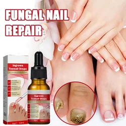 Extra Strong Nail Fungus Treatment Serum Essence oil Feet Nails Repair Care Essence Cream Anti Infection Toe Fungal Removal