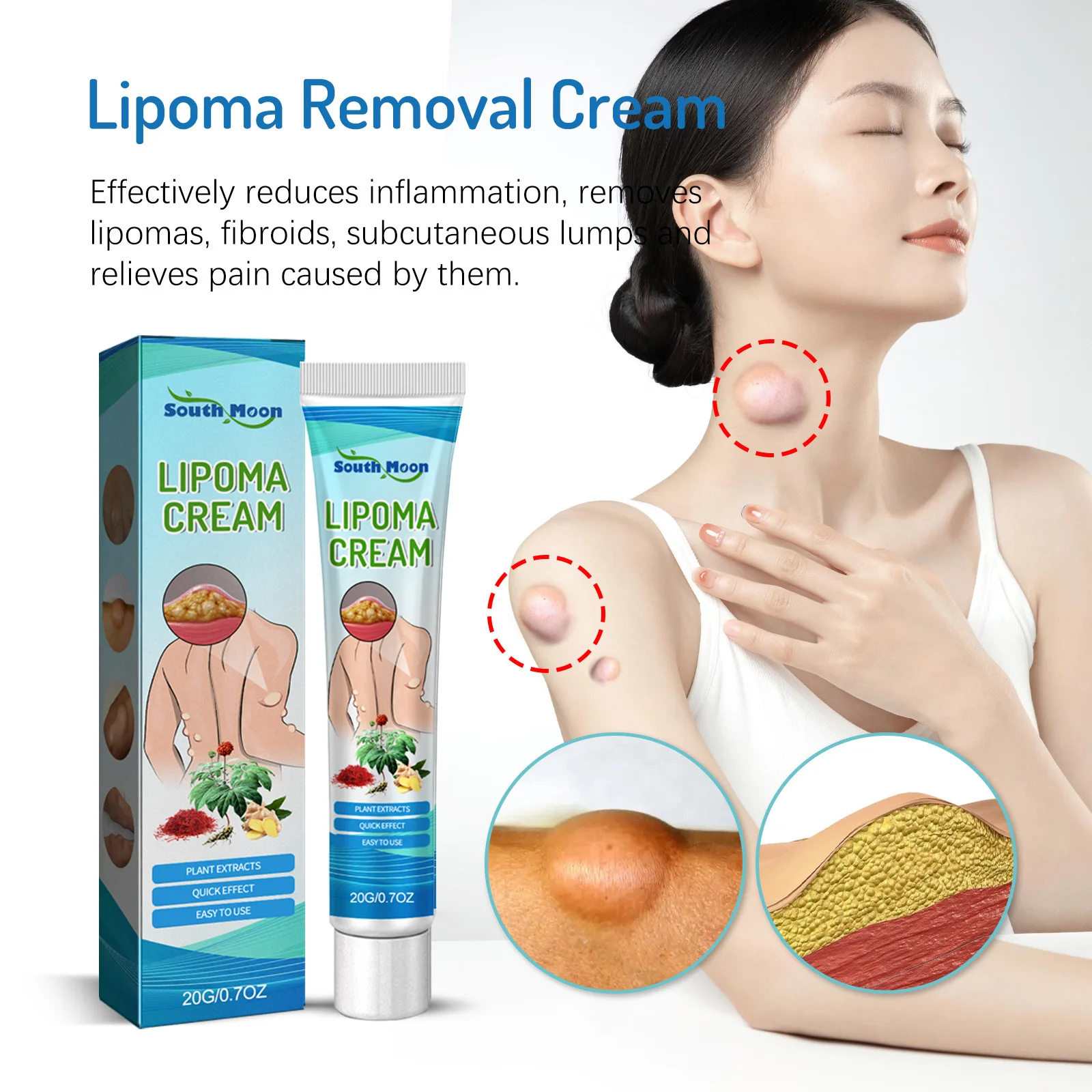 Lipoma Removal CreamAnti-infammatery From Within The Skin Body Care Apply Topical Cream Daily