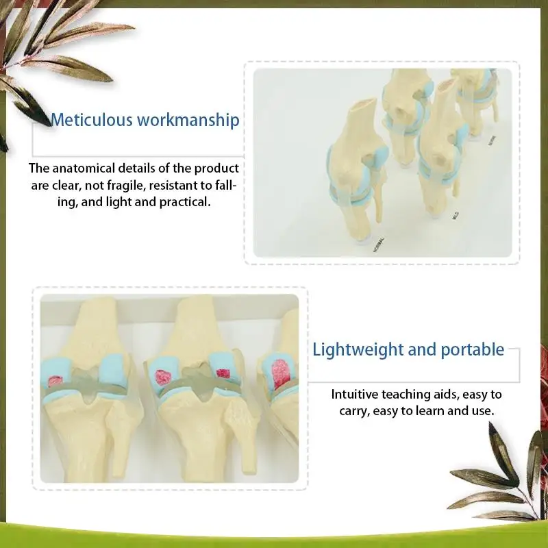 

New-Anatomical Human Degenerative Knee Joint Model Skeleton Anatomy Teaching Resources