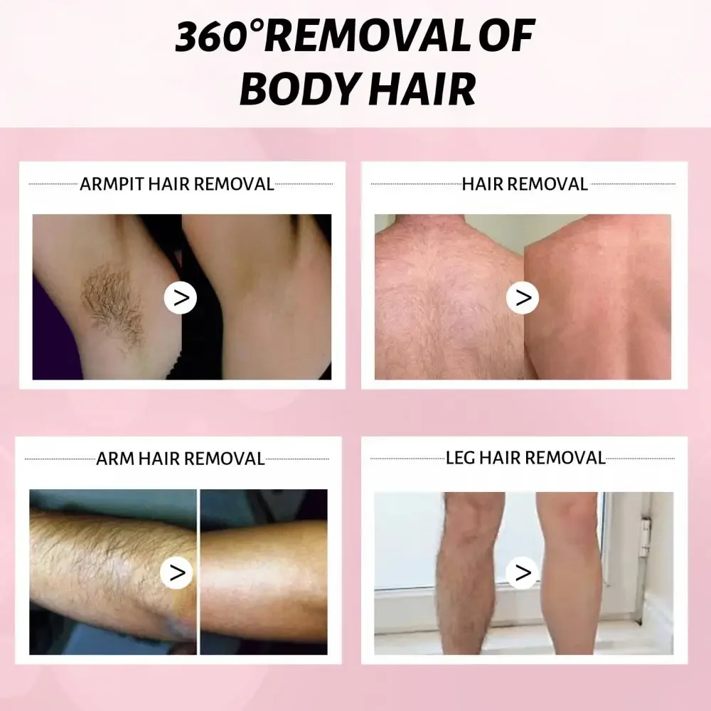 Krem do usuwania włosów Inhibition wzrostu włosów Trwałe usuwanie nóg Broda Bikini Intymne pod pachami Bezbolesne depilatory piękno-zdrowe