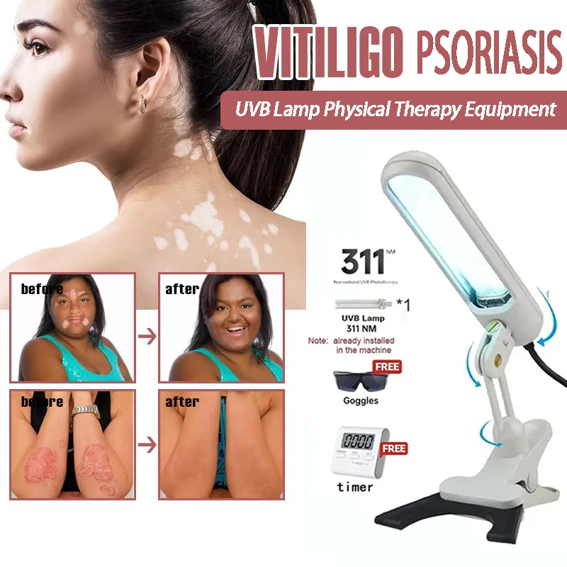 

311NM UVB Phototherapy Lamp Device for Vitiligo Treatment Uv NarrowBand Ultraviolet Light UvB Therapy Psoriasis Lamp