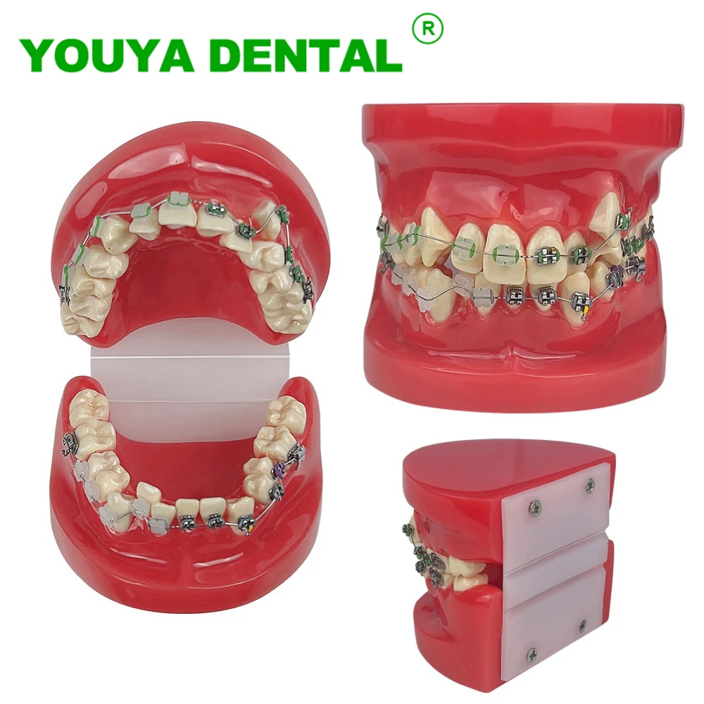 Dental Orthodontic Teeth Model With Metal & Ceramic Brackets Dentistry Treatment Demonstration Typodont Model For Dentist Study