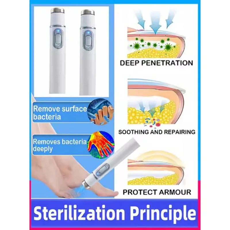 Upgrade nail laser pen treatment equipment for gentle penetration and restoration of natural luster