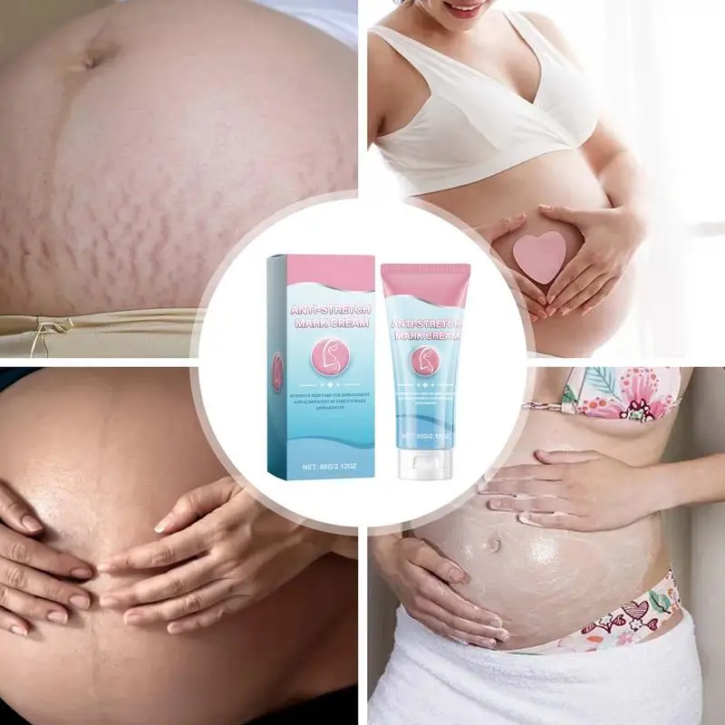 Pregnancy Belly Cream 60g Pregnancy Skin Care Cream Hydrating Scar And Belly Cream Anti-Stretch Natural Remover For Enhances