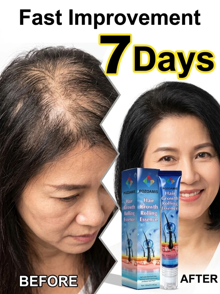 Daily Use Scalp Nourish Hair Serum with Roller‑Ball, Softly Care for Hair Roots, Improve Thin Sparse Hair Look, Easy Rolling Massage Application, Refreshing Liquid Essence for Household Hair Beauty Routine