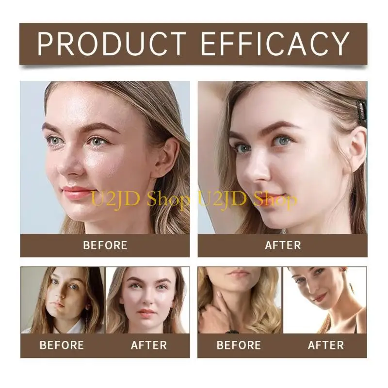 U2JD نظرة طبيعية على حزام رفع الوجه قابلة للتعديل لرفع الذقن ورفع الخد