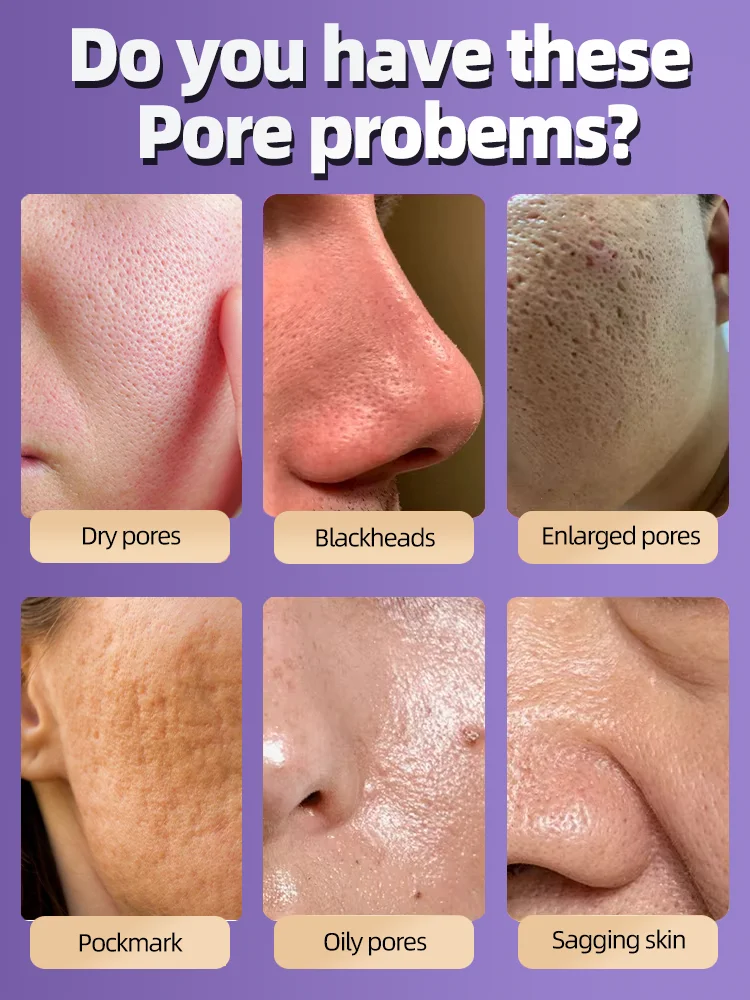 Solve Large Pore Problems