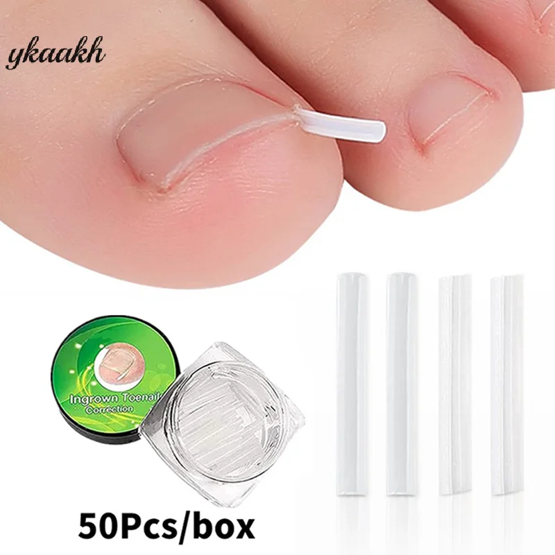 

50Pcs Ingrown Toenail Correction Tool Ingrown Toe Nail Treatment Elastic Patch Sticker Straightening Clip Brace Pedicure Tool