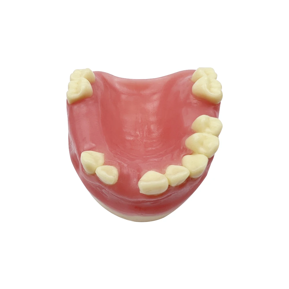 Dental Model Implant Teeth Model Practice Dentist Dental Students Training Studying Examation Teaching Education Display Models