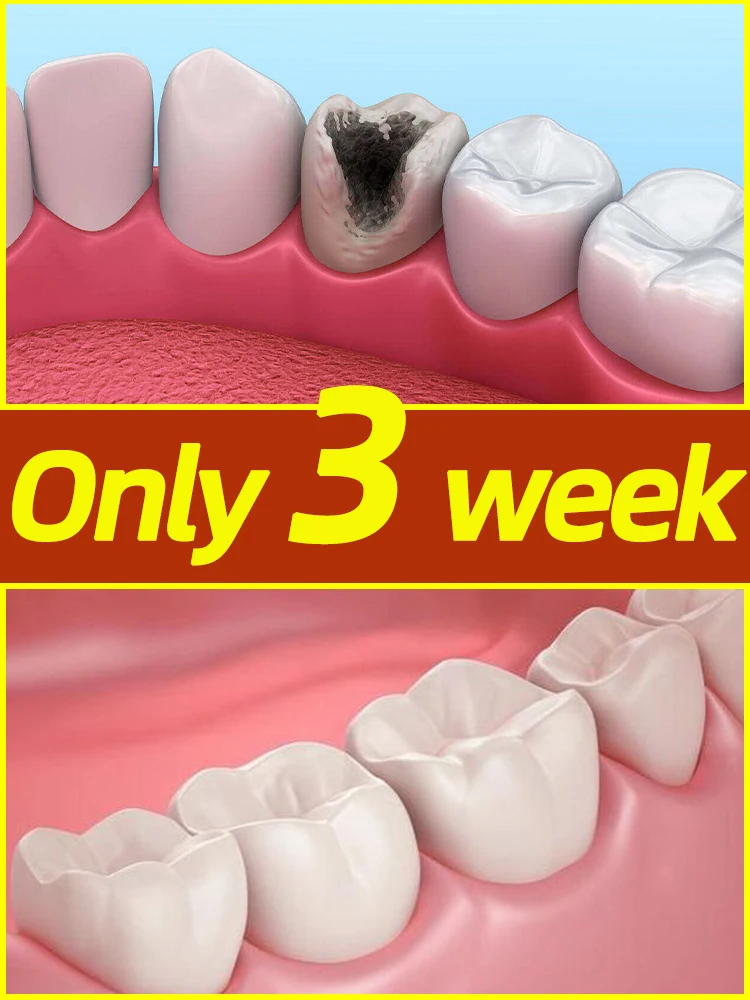 Anti-cavity repair tooth decay remove plaque