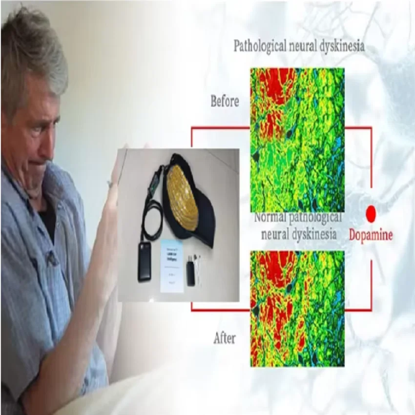 

Physiotherapy LED Brain Therapy Helmet Cap 1070nm &810 Migraine Headache Relief Photobiomodulation Treatment Parkinson Alzheimer