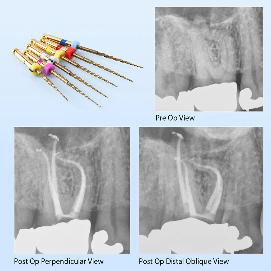 Dental Gold Flexible Feilen Endo Endodontische Wurzelkanal-Rotationsfeilen 21/25/31mm für Motoranwendung NiTi Zahnmedizinische Instrumente AZDENT – Detail 11