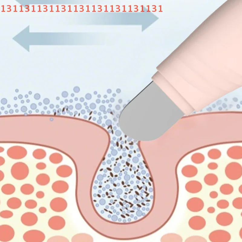 ملعقة كريم أساس لحب الشباب، مزيل الرؤوس البيضاء للأنف، أداة العناية بالبشرة، أداة إزالة الرؤوس السوداء للوجه، مكشطة الوجه، تنظيف عميق