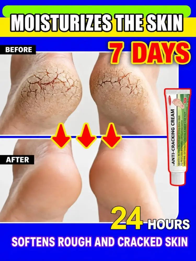 Anti-Dry Crack Skin Balm, Hand & Foot Moisturizing Care Cream, Form Protective Barrier to Lock Moisture, Soften Cuticles, Quick Absorption for Dry Rough Skin