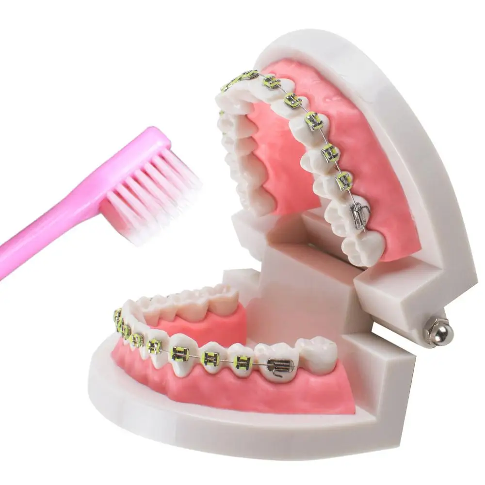 Perfecte Mondverzorging: V-Vormige Orthodontische Tandenborstelset-4 Stuks Voor Beugels, Inter-Tandheelkundige En Tandenborstel