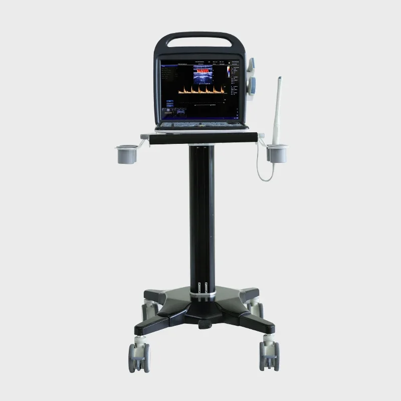 Chinese High-End Color Doppler High Quality Ultrasound Machine Trolley Ultrasound Machine Color Doppler Ultrasou