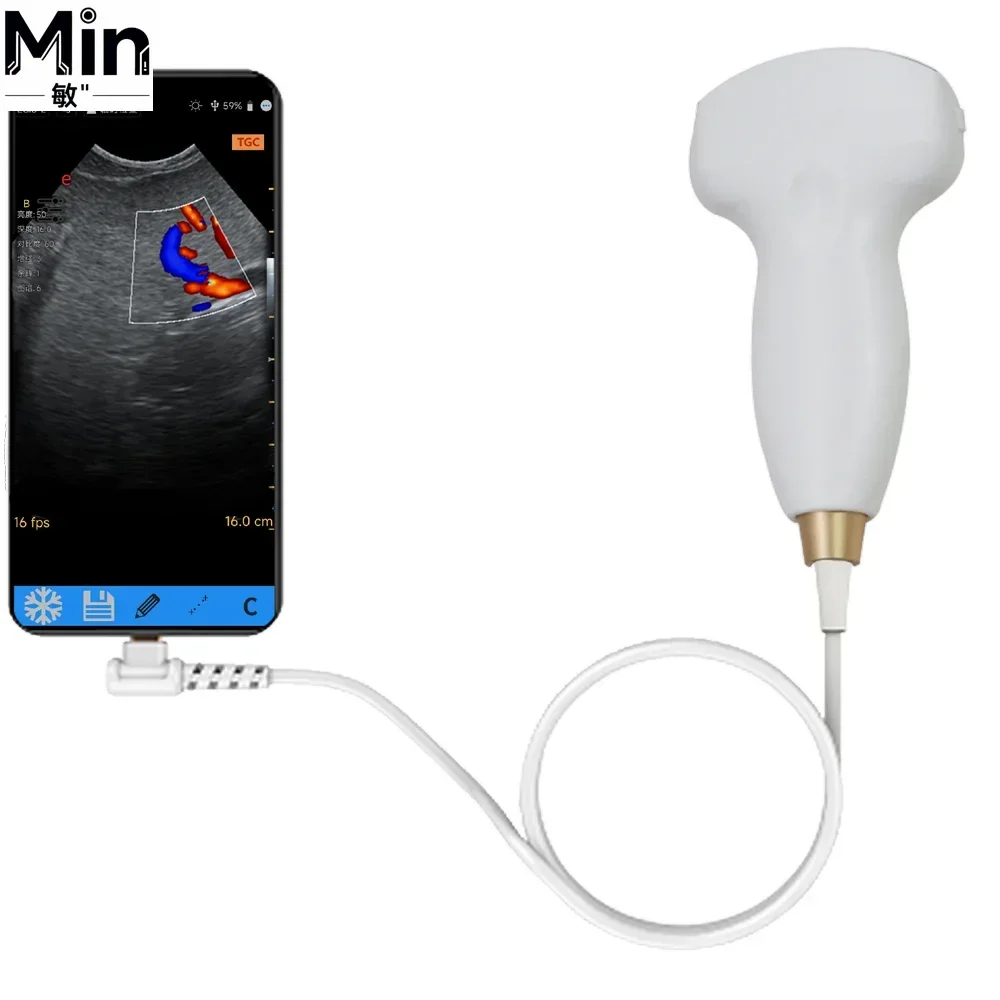 

Visbull VS-V557 16-Channel Linear Veterinary Probe for Cattle, Horses & Pigs