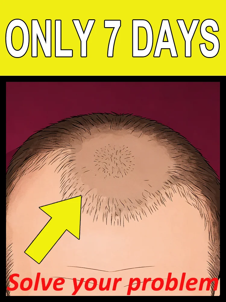 

2026 Продукты для решения проблем с кожей головы, инструменты для восстановления, специальные предложения, бесплатная доставка, унисекс