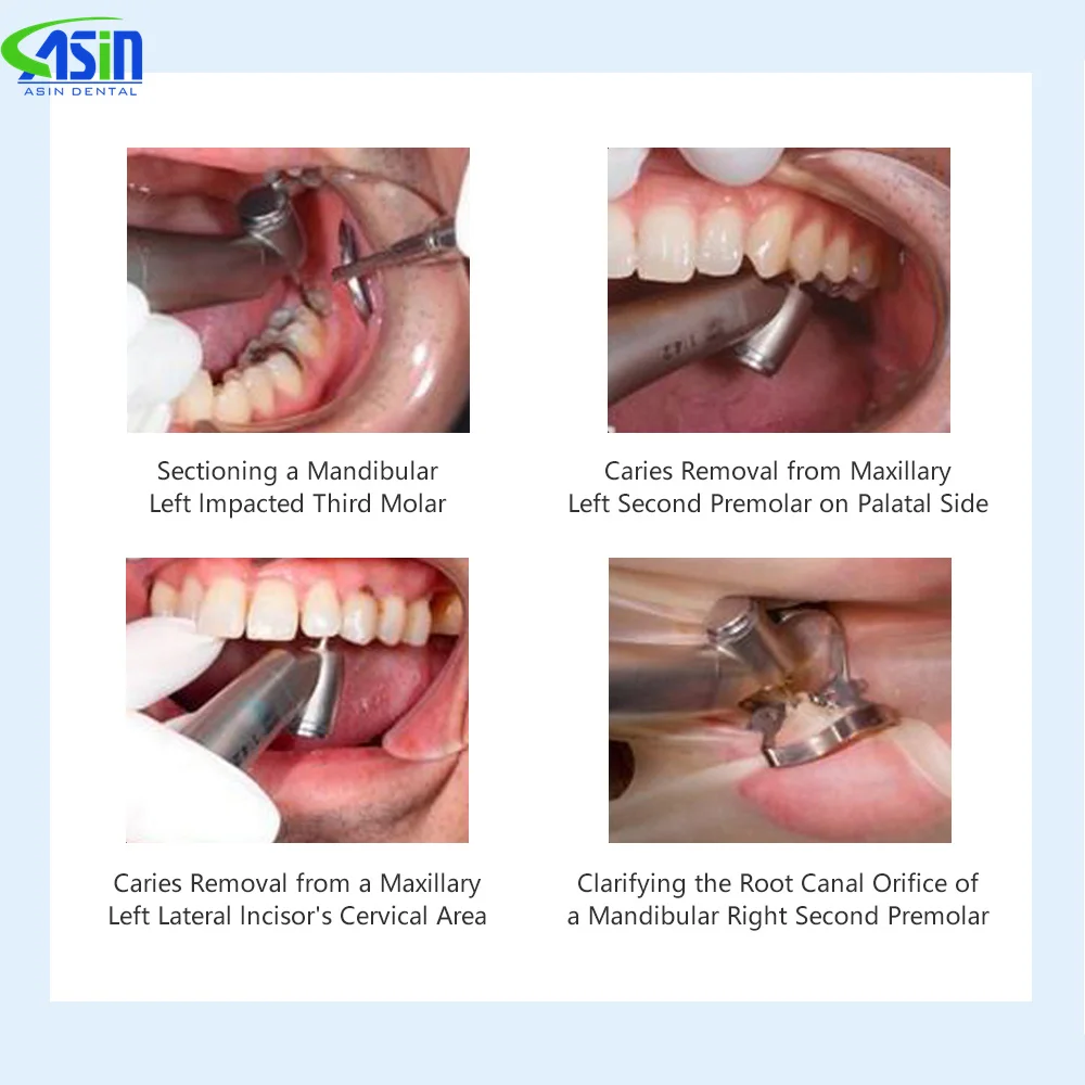 Dental Surgical contraangulo 1:5/20:1/1:4.2 Handpiece with tube Against LED Optic Fiber Contra Angle for electric micromotor