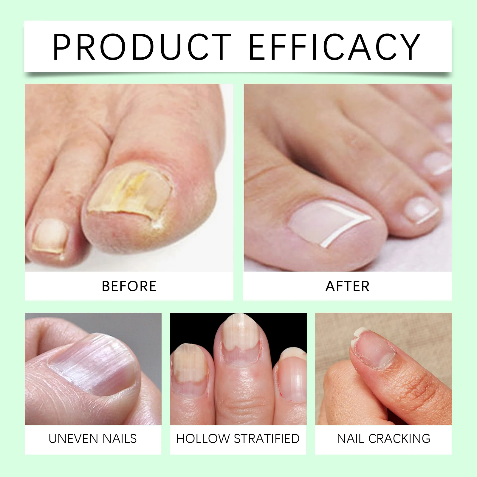 

Nail Nutrition Oil Pen Prevent Agnail Nail Polish Dry Cracked Nail Treatment Cuticle Repair Oil Finger Toe Beauty Health Product