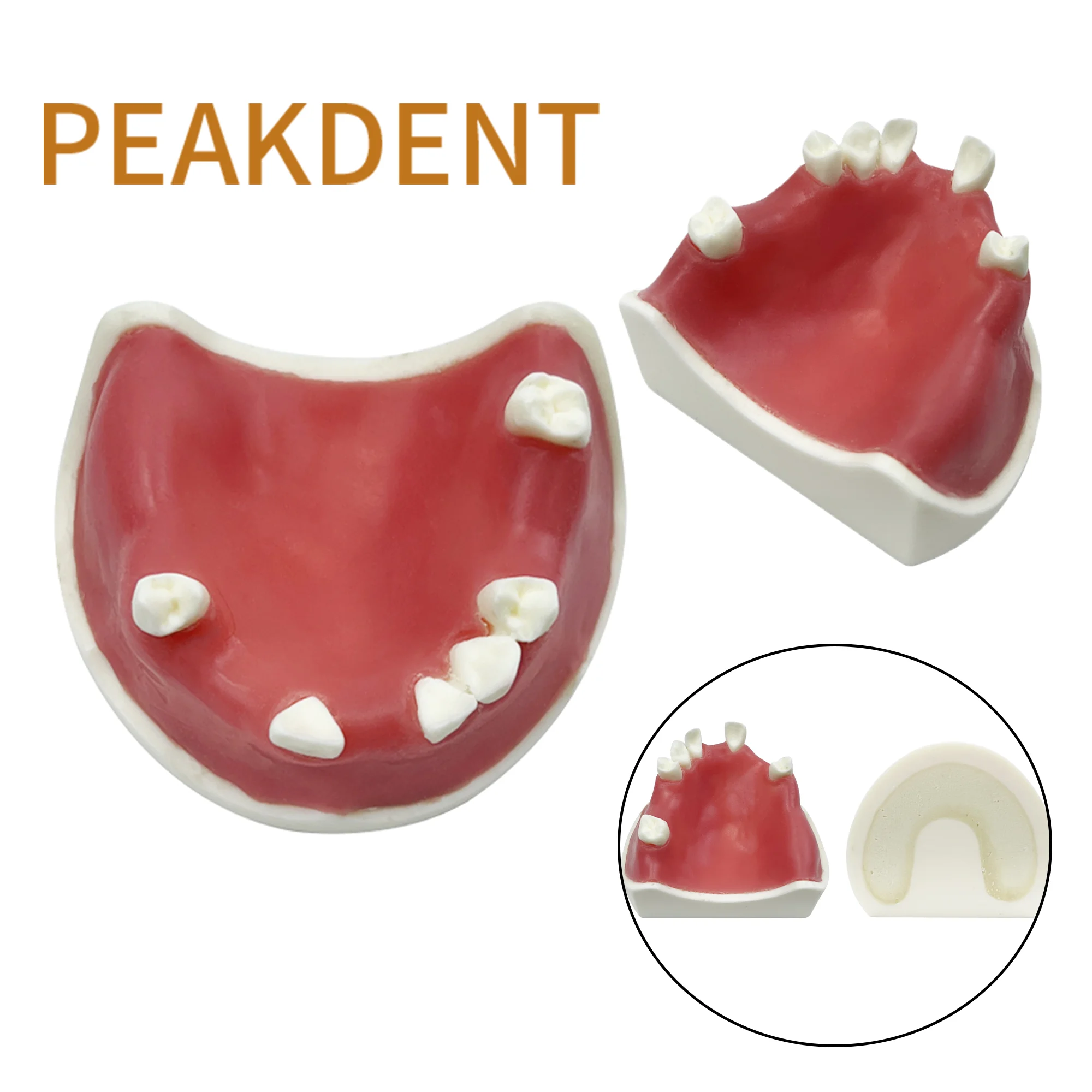 Dental Implant Model Teeth Restoration Teaching Study Model Typodont With Soft Gums Teaching Models Medical Dentistry Products