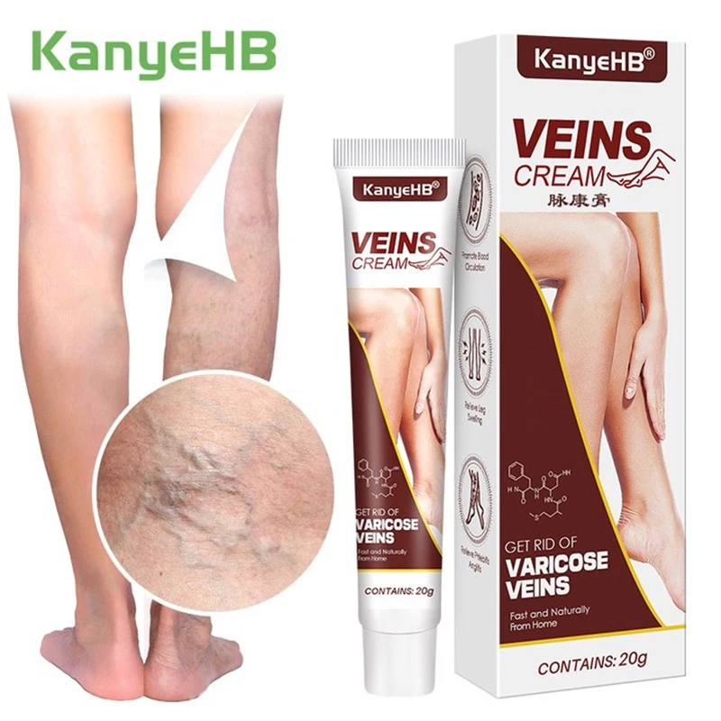 Effektive Venen reparatur Creme Bein Vene Ausbuchtung Schmerz Maikang Bein pflege Crema Para Blanquear La Cara Haut aufhellung creme