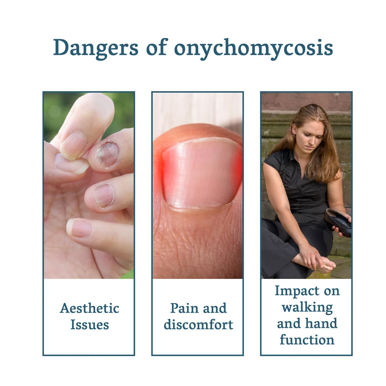 Płyn do pielęgnacji paznokci u stóp na grzybicę, leczenie szarego grzybicy paznokci, onychomikoza, antyinfekcyjny, odżywczy, regenerujący, naprawczy esencja do stóp.