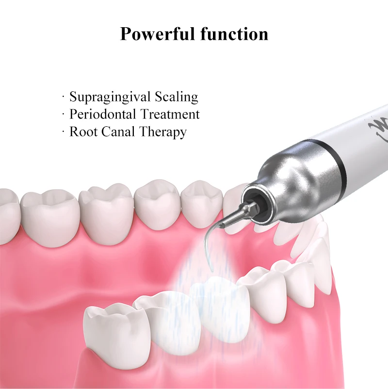 Рисунок 2 - VVDental Модернизированный ультразвуковой