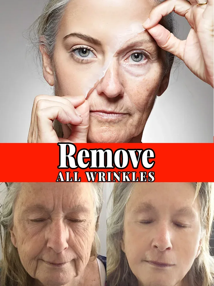 removes wrinkles,anti wrinkle serum, nasolabial folds, forehead lines, crow's feet, neck lines, anti-aging,  skin care