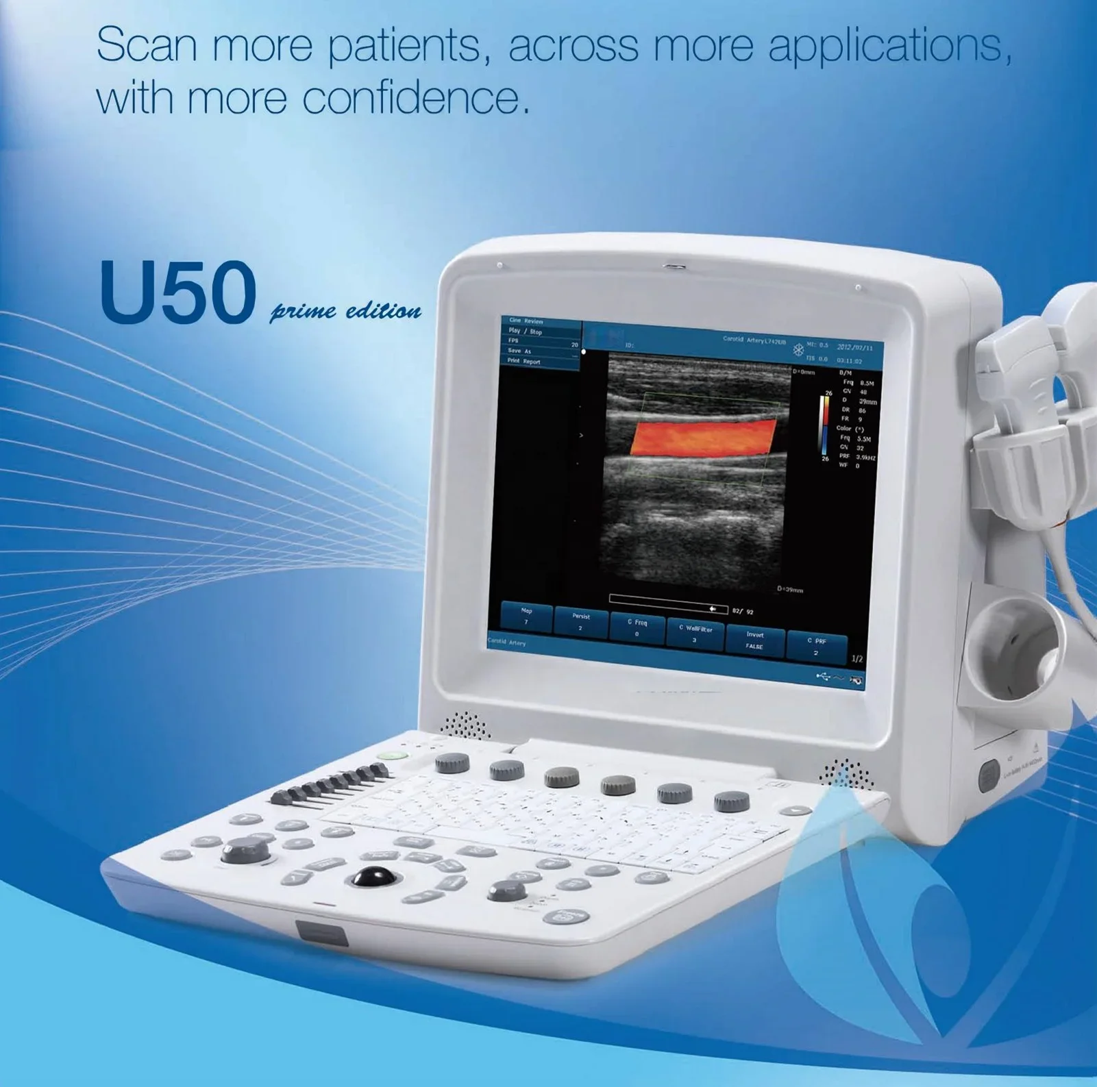 EDAN U50 Scanner Machine ecografo ultrasonido Laptop Color Doppler portable ultrasound price