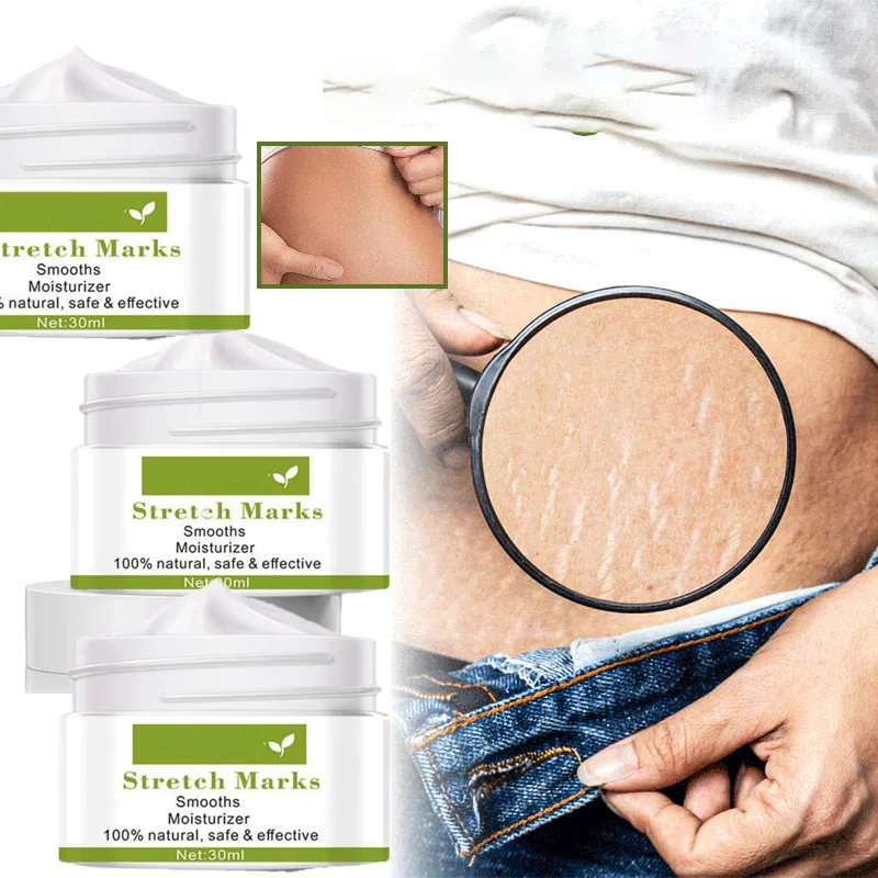 

3 件装 Stretch Marks Removal Cream Maternity Pregnant Women Pregnancy Anti-Winkle Smooth Repair Firming Skin Body Skin Care