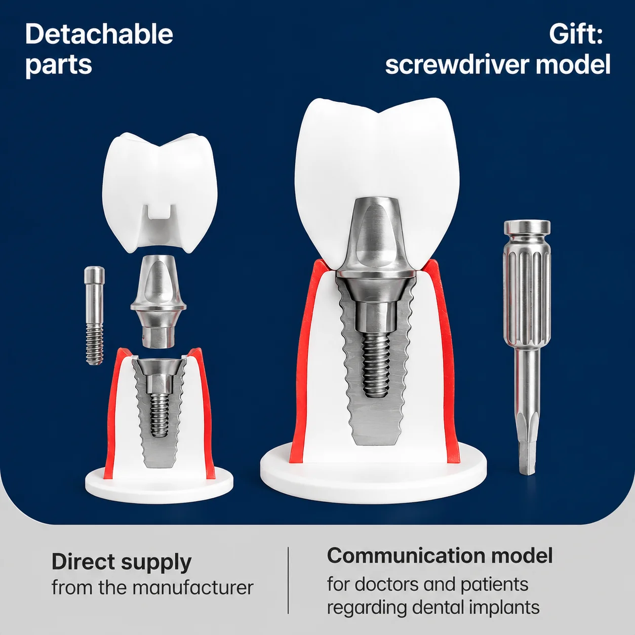 Dental Implant Model Dentist Training Teaching Demonstration Model One Set Maxillary Mandibular Overdenture Teeth Typodont