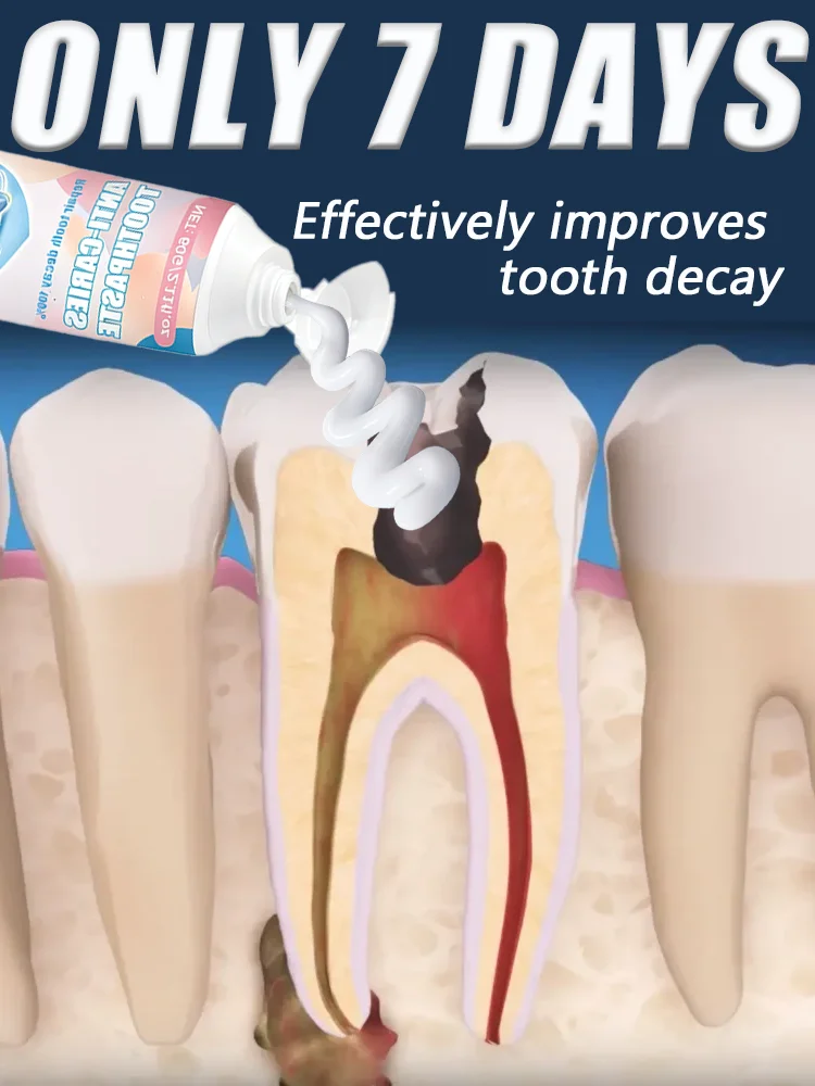 

Dᴇᴇᴘʟʏ ᴘʀᴏᴛᴇᴄᴛs ᴀɢᴀɪɴsᴛ ᴄᴀᴠɪᴛɪᴇs ᴀɴᴅ ɢᴜᴍs; sᴜɪᴛᴀʙʟᴇ ғᴏʀ ᴛʜᴇ ᴡʜᴏʟᴇ ғᴀᴍɪʟʏ.