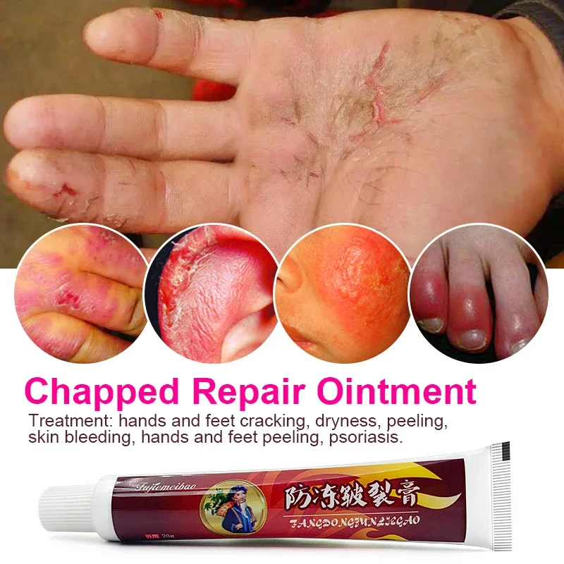 1Pcs Anti-Drying Crack Ointment Hand Foot Heel Cracked Repair Plaster Removal Dead Skin Care Chinese Herbal Medicine Cream S101