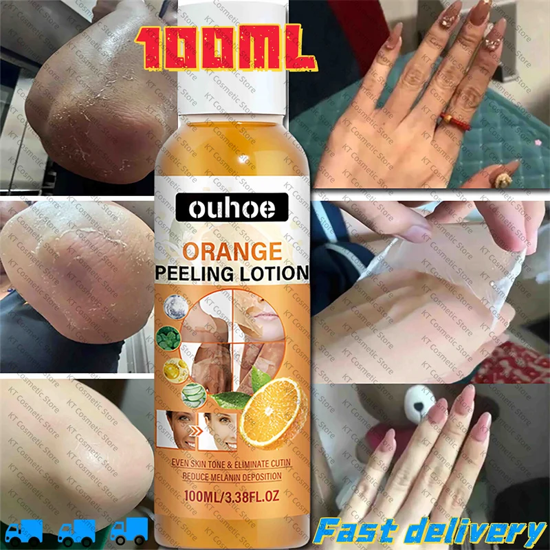 

Yellow Peeling Oil Bleaching Face Body Dark Skin Brighten Whiten Lotion Hand Foot Dead Skin Peel Exfoliate Nourish New Skin Tone