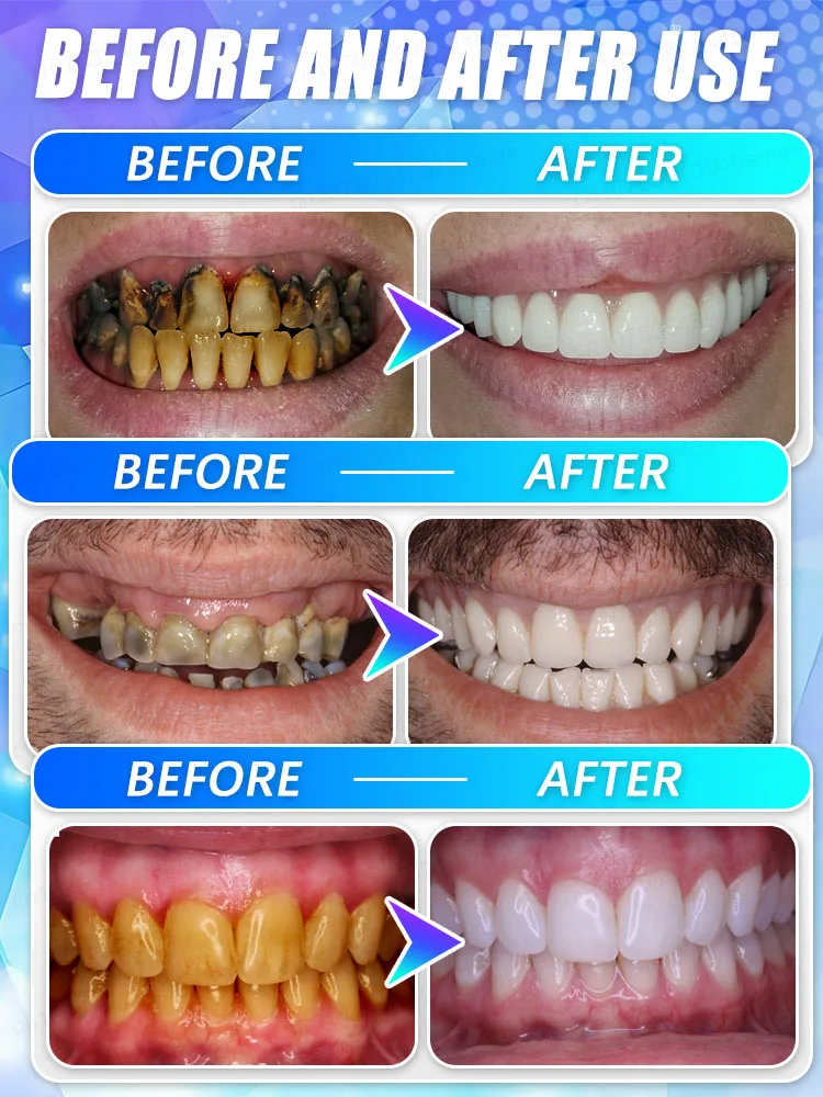 2025 latest development of new technology mineral powder for effective whitening and plaque cleaning