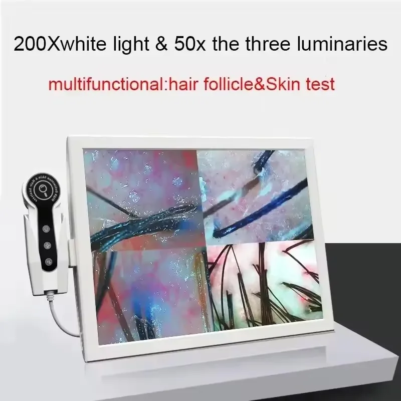 HD Digital Skin Analyzer Professional Hair Scalp Camera Detector Hair Follicle Oil Moisture Test Device 15inch 2026