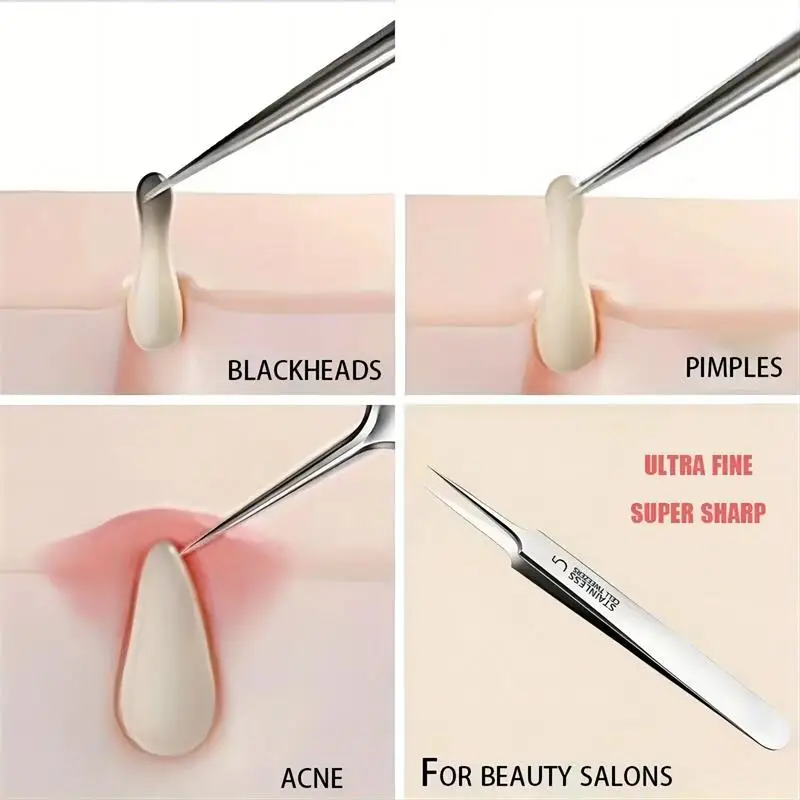 Blackhead Removal แหนบสแตนเลสลบเข็มสิว Whiteheads กําจัดสิวเครื่องมือทําความสะอาดลึก Facial Beauty CELL CLAMP ﻿