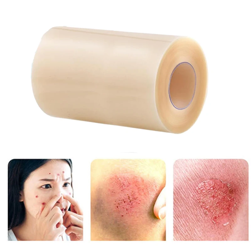 1 rollo de rollo hidrocoloide para el cuidado de heridas, vendajes hidrocoloides con autoadhesivo, vendajes para dolor de cama, altamente absorbentes