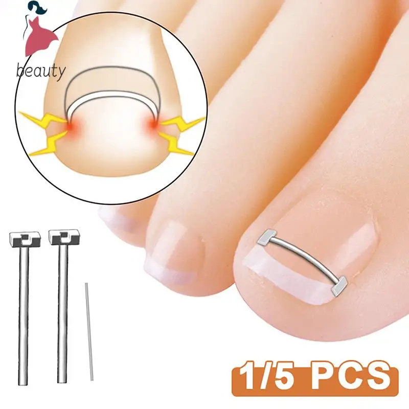 Corrector de uñas encarnadas, herramienta de pedicura, tratamiento profesional de uñas encarnadas, Clip alisador