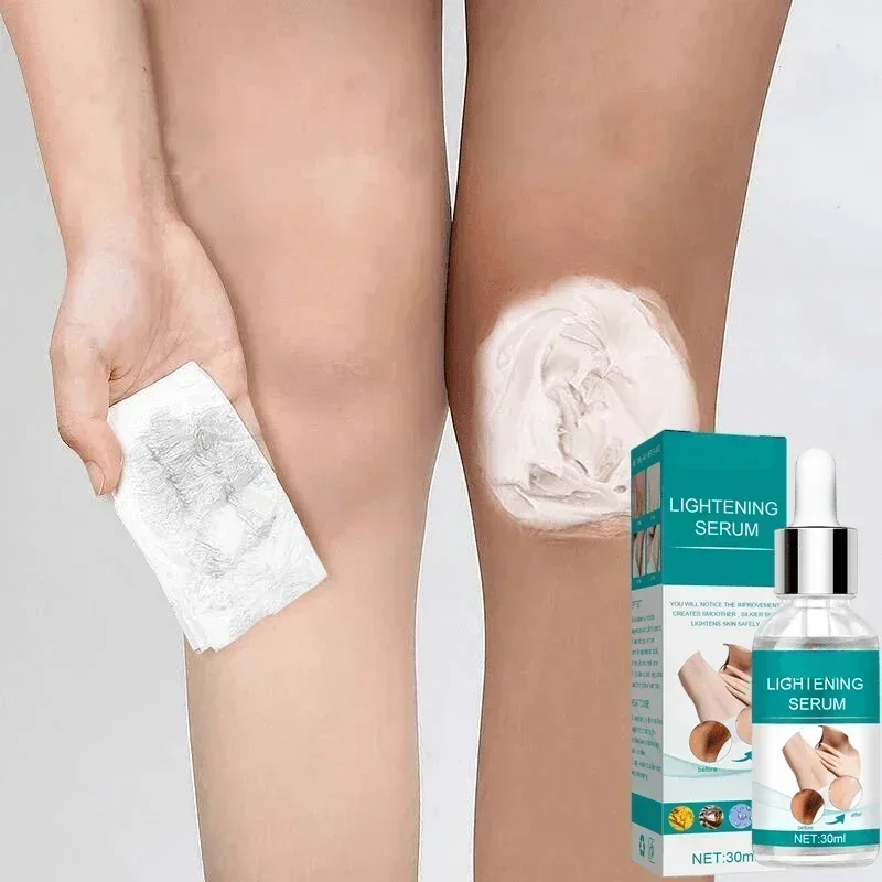 Skin Whitening Serum Private Parts Underarm Bleaching Serum Whiten Butt Knee Brighten Inner Thigh Arm Body Remove Dark Melanin