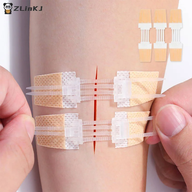 ▶ Reißverschluss-Wundpflaster: Schmerzfreier Wundverschluss, Nahtfreie Wundauflage, Zip-Suture-Reduzierer, Tragbares Outdoor-Pflaster
