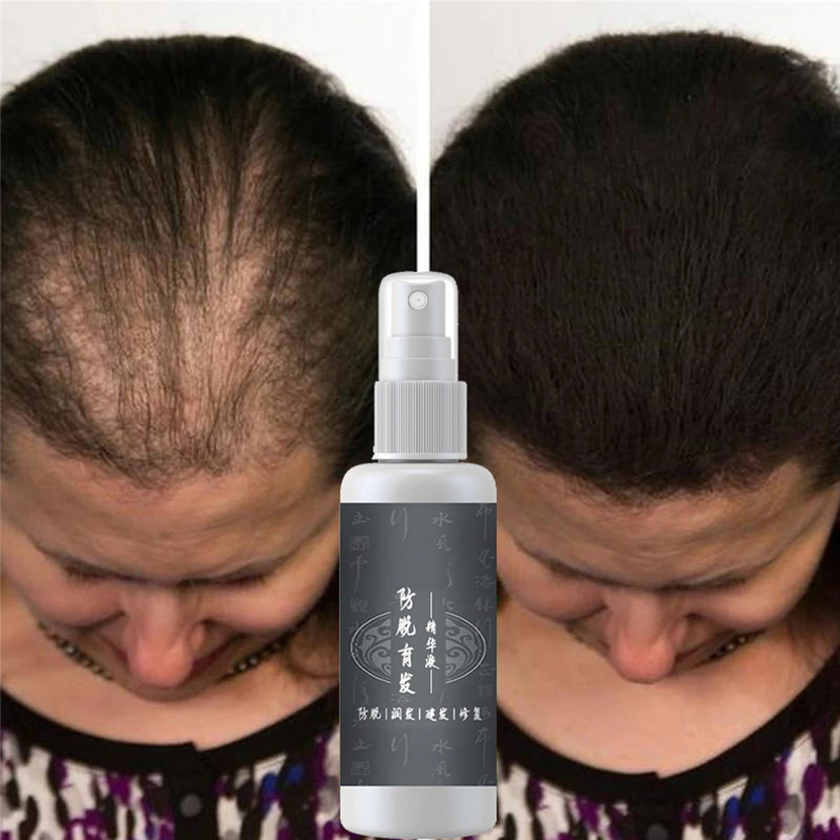 Hair Tonic Serum Fast Growth Serum For Men &Women Head Care Products Anti Hair Loss Serum