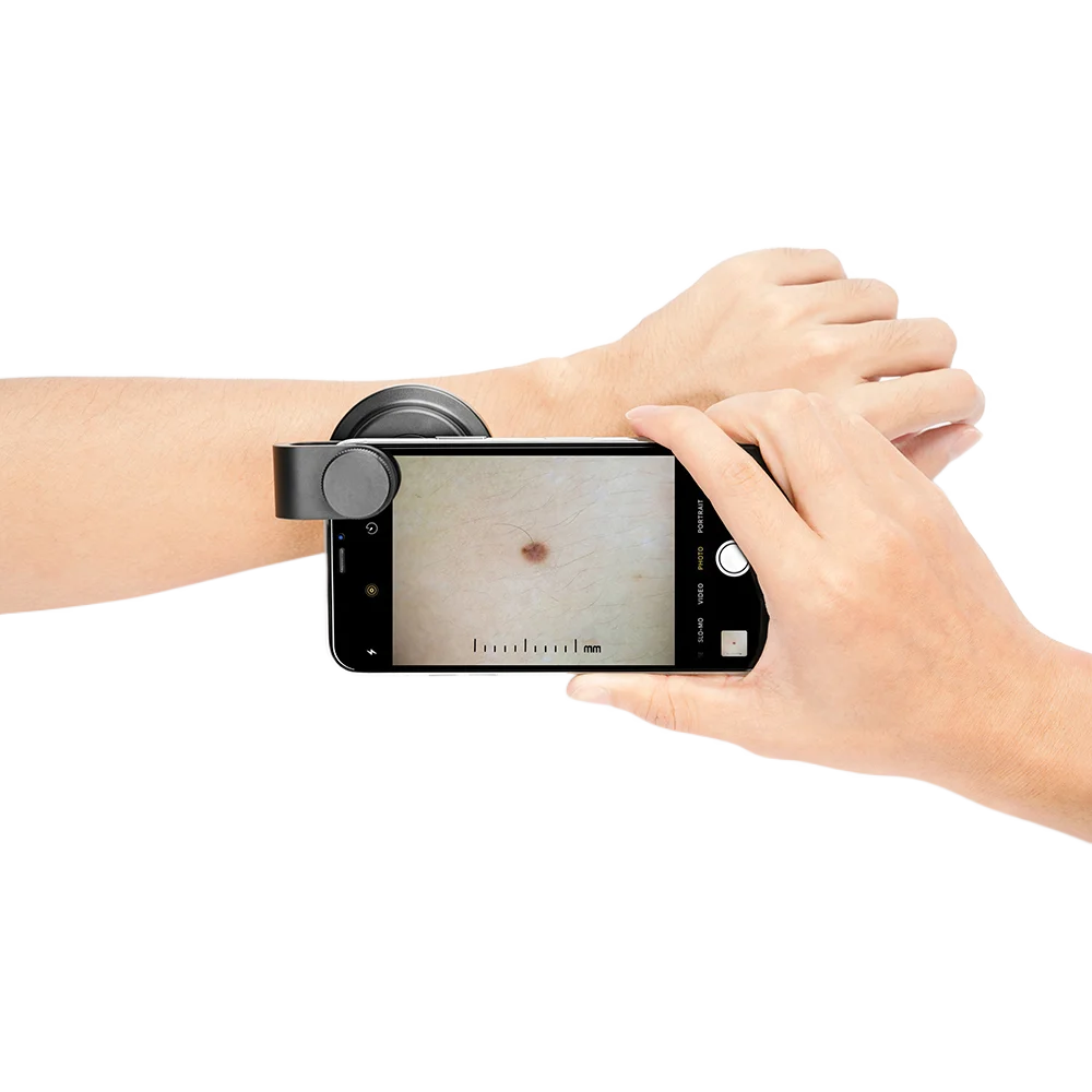 IBOOLO DE-400 Wholesale Price Ski=n Dermatology Dermascope, 10X Macro Lens Magnify Dermatoscope